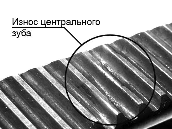 Износ зуба