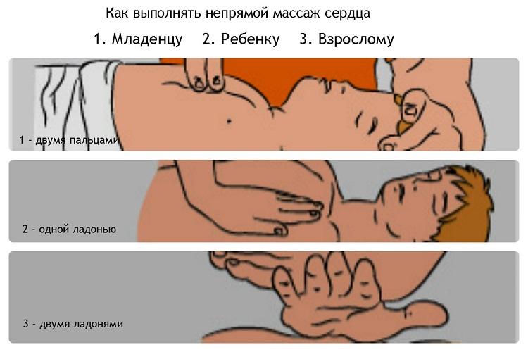 помощь при отравлении выхлопными газами